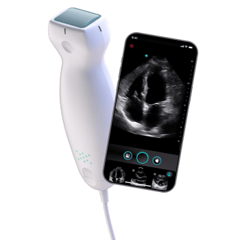 Exo-Iris-probe-and-phone Exo-Iris-probe-and-phone